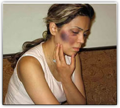 Иранская христианка, избитая полицией