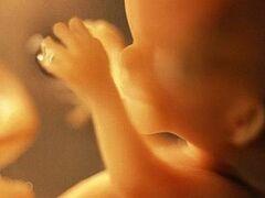 Суд в Британии постановил стерилизовать многодетную мать