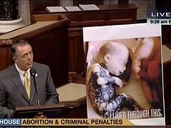 Нижняя палата Конгресса США: убийство детей, родившихся в результате аборта - преступление